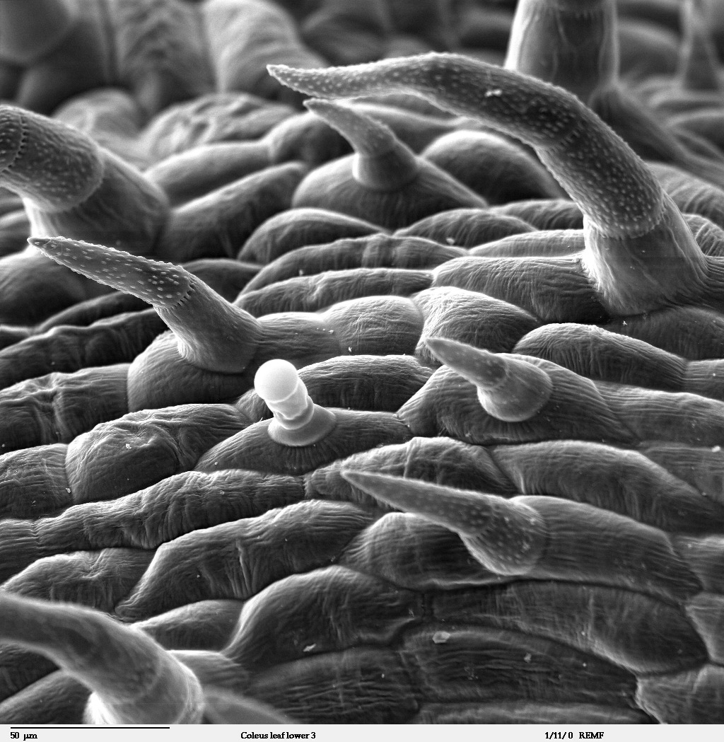 Tricomas al microscopio electrónico de barrido