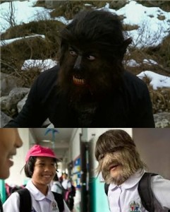 Imagen de hombres lobos del cine junto a casos reales de Hipertricosis. Caso 2.