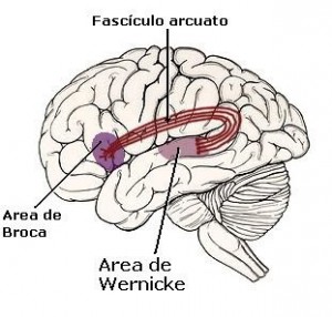 Síndrome del acento extranjero