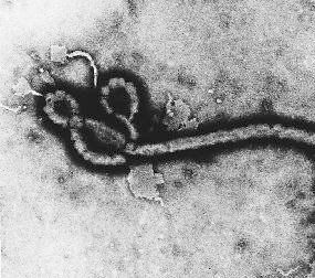 Imagen del virus ébola tipo Zaire, causante del brote de ébola del año 2014.