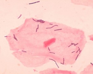 Las bacterias del género Lactobacillus son las más representativas de la microbiota de la vagina.