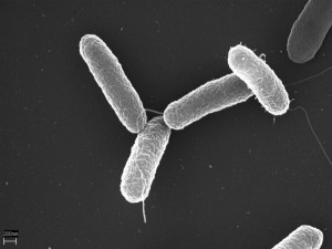 Imagen de Salmonella typhimurium.