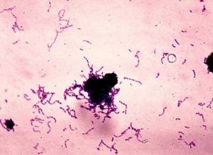 Streptococcus mutans es una bacteria que está implicada en la caries dental.