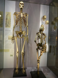 La osamenta de Charles Byrne se expone al público en el museo Hunter que existe en el Colegio de Cirujanos de Londres. A su lado, se muestra un esqueleto normal al que se conoce como "Mr. Jeffs".