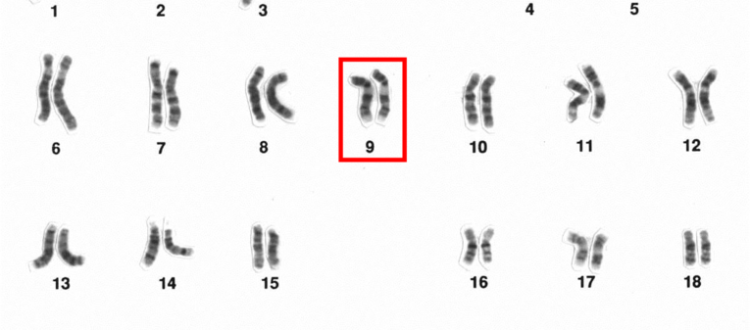 Cariotipo con el cromosoma 9 resaltadao (National Human Genome Research Institute)