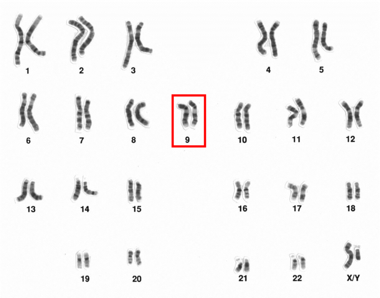 Cariotipo con el cromosoma 9 resaltadao (National Human Genome Research Institute)